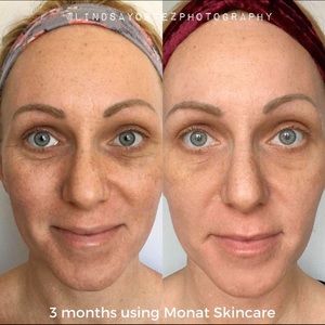 monat eye smooth results